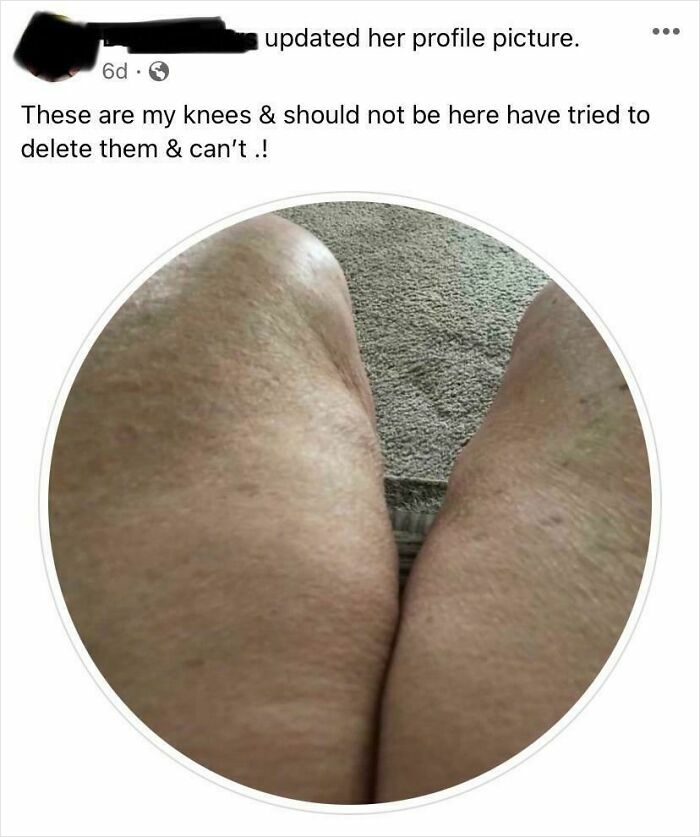 Elderly people humorously proving they shouldn't have unsupervised access to the internet, posting knees as a profile picture.