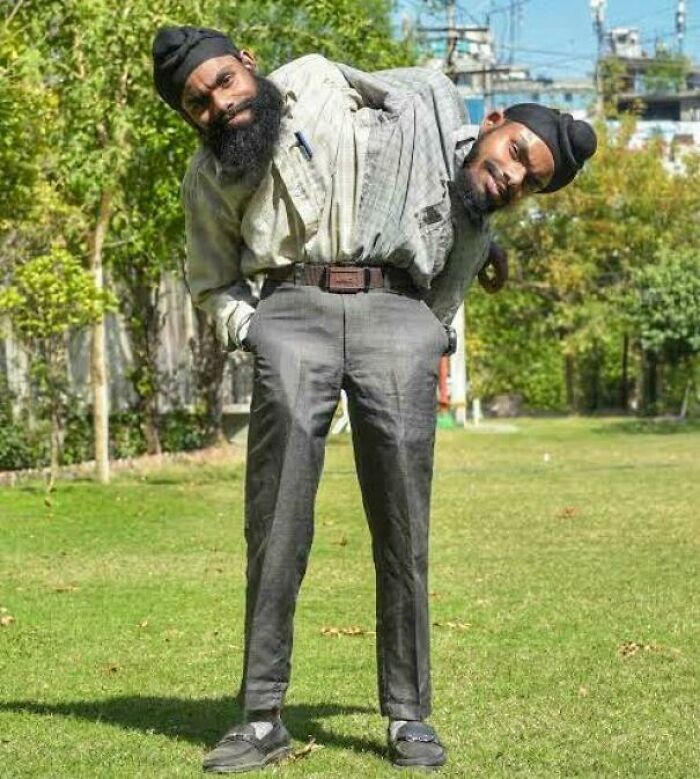 Sohna And Mohna Singh Are Conjoined Twins From Punjab, India. Born In 2003 With Two Hearts And Two Pairs Of Arms But Shared Legs, Liver, And Gallbladder. Abandoned At Birth, They Were Raised In A Shelter And Now Work As Electricians For The Punjab State Power Corporation