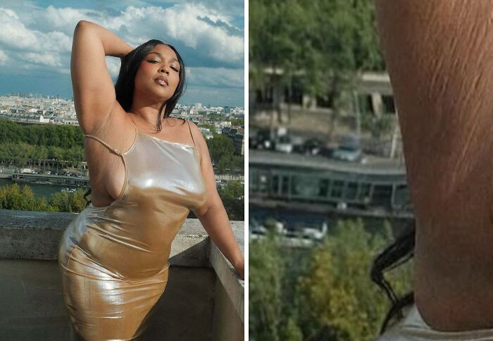 A plus-size woman posing on a balcony, with a close-up of a leg showing stretch marks on social media.