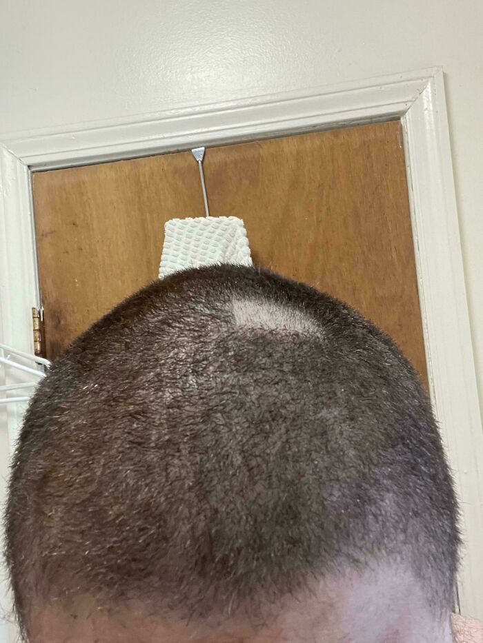 A close-up of a person's head with an uneven haircut, showing a patch of missed hair, exemplifying forgetting something important.