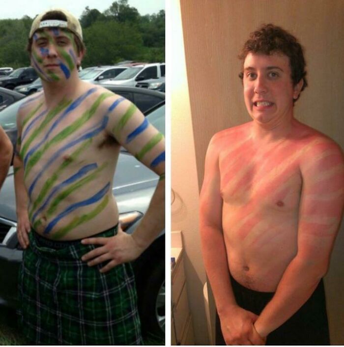 A man with body paint on the left, and severe sunburn in the same pattern on the right, ruining his entire day.