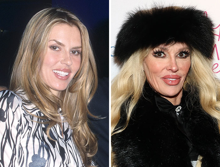 Shauna Sand pre-plastic surgery and post-plastic surgery comparison photos of celebrities.