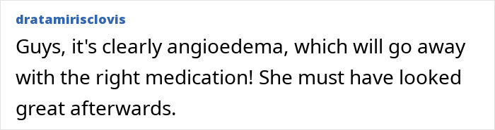 An expert comment identifying angioedema after a woman's dramatic cosmetic procedure, stating it resolves with medication. An expert comment identifying angioedema after a woman's dramatic cosmetic procedure, stating it resolves with medication.
