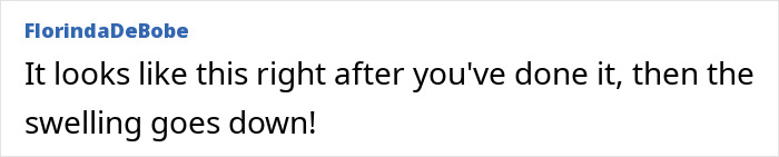 A comment describing the temporary swelling after a woman's dramatic cosmetic procedure, noting it eventually subsides. A comment describing the temporary swelling after a woman's dramatic cosmetic procedure, noting it eventually subsides.