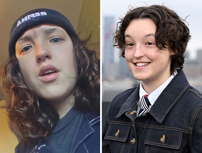 Two images of the same star who many have no idea is on the autism spectrum.