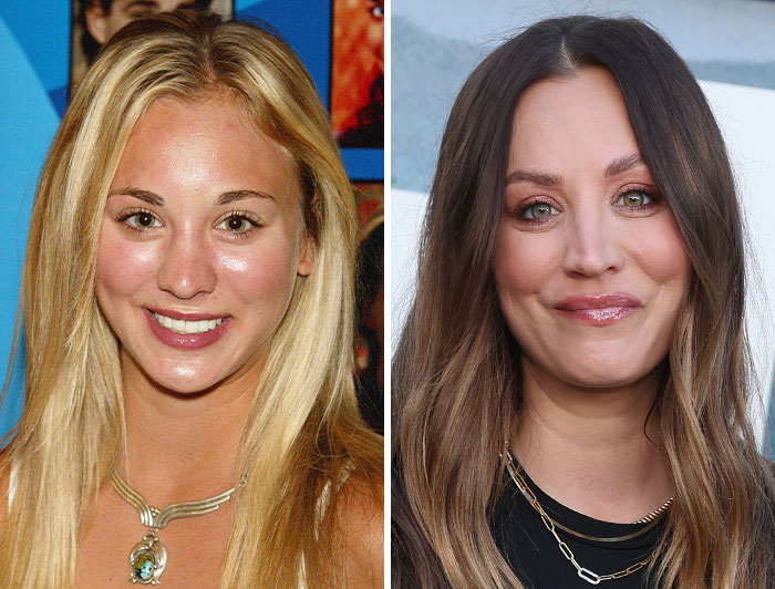 Kaley Cuoco before plastic surgery on the left, compared with her current look, illustrating celebrity cosmetic changes.