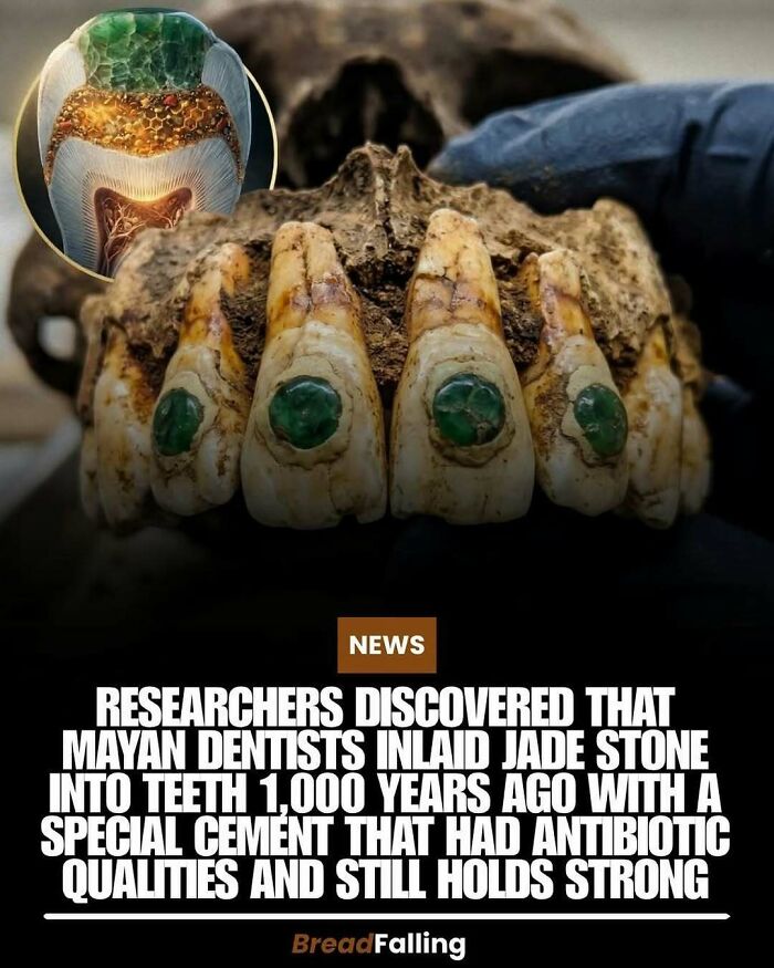 A close-up of ancient Mayan teeth with inlaid jade stones, showcasing interesting facts about Mayan dentists.