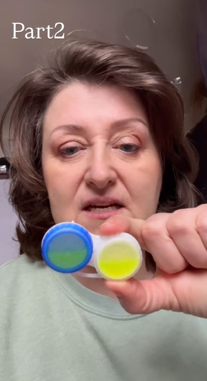 Woman holding a contact lens case with green liquid, showing the fluorescent pupils explanation. Woman holding a contact lens case with green liquid, showing the fluorescent pupils explanation.