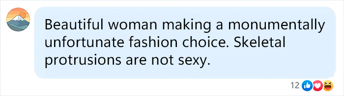 Social media comment on Olivia Wilde's dramatically slimmer frame, criticizing her fashion choice and skeletal protrusions. Social media comment on Olivia Wilde's dramatically slimmer frame, criticizing her fashion choice and skeletal protrusions.