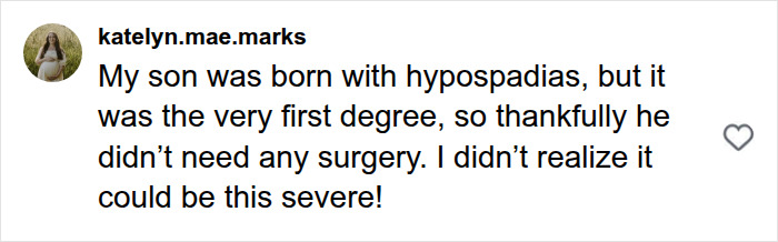 A social media comment from a mom whose son was born with hypospadias, expressing surprise at the severity of the disease.