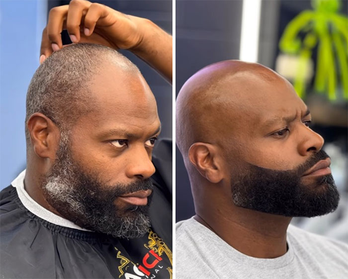 Before-and-after men's hair and beard transformation by Barber Emiliano Familia, featuring a clean shave.