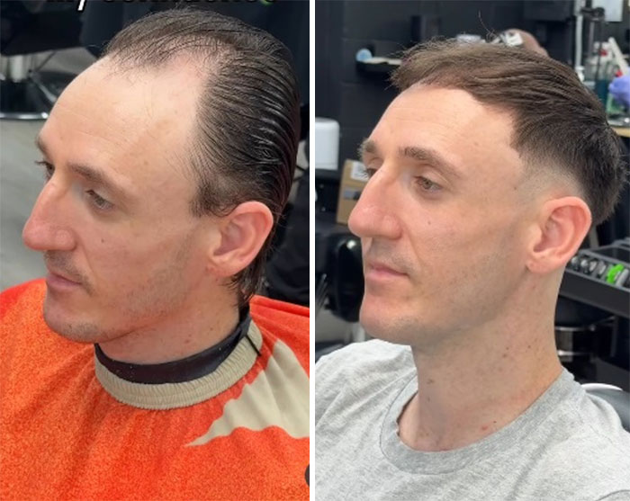 Men's hair and beard before-and-after pic by Barber Emiliano Familia, illustrating a remarkable improvement.