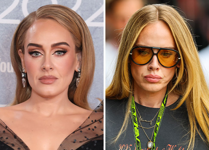 Comparison of Adele's appearance, highlighting changes that led to viral discussion and plastic surgeon speculation. Comparison of Adele's appearance, highlighting changes that led to viral discussion and plastic surgeon speculation.