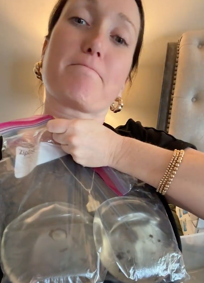 Woman holding a Ziploc bag with her removed breast implants, showing their appearance. Woman holding a Ziploc bag with her removed breast implants, showing their appearance.