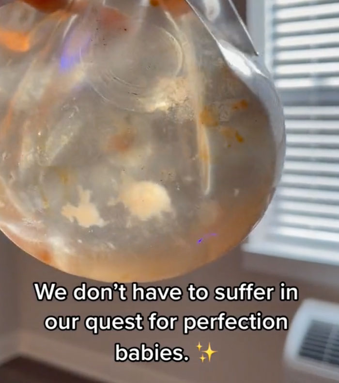 Close-up of a removed breast implant, revealing a murky substance, highlighting the hidden discoveries. Close-up of a removed breast implant, revealing a murky substance, highlighting the hidden discoveries.