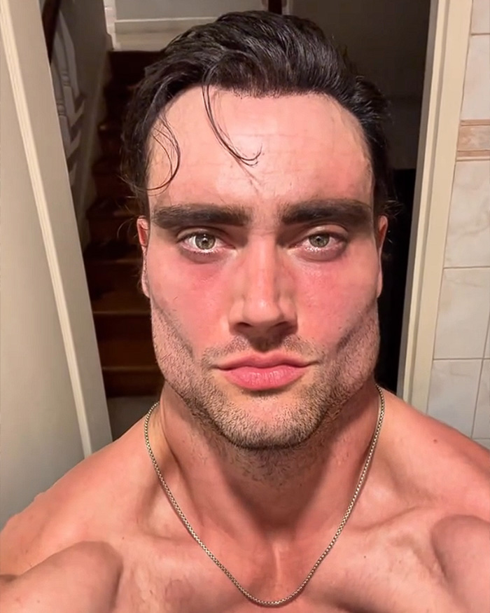 Close-up of a lookmaxxer's face with a defined jawline, revealing his extreme transformation. Close-up of a lookmaxxer's face with a defined jawline, revealing his extreme transformation.
