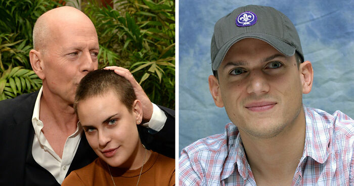 After Singer’s Unexpected Autism Diagnosis Reveal, Here Are 17 Stars Many Have No Idea Are On The Spectrum