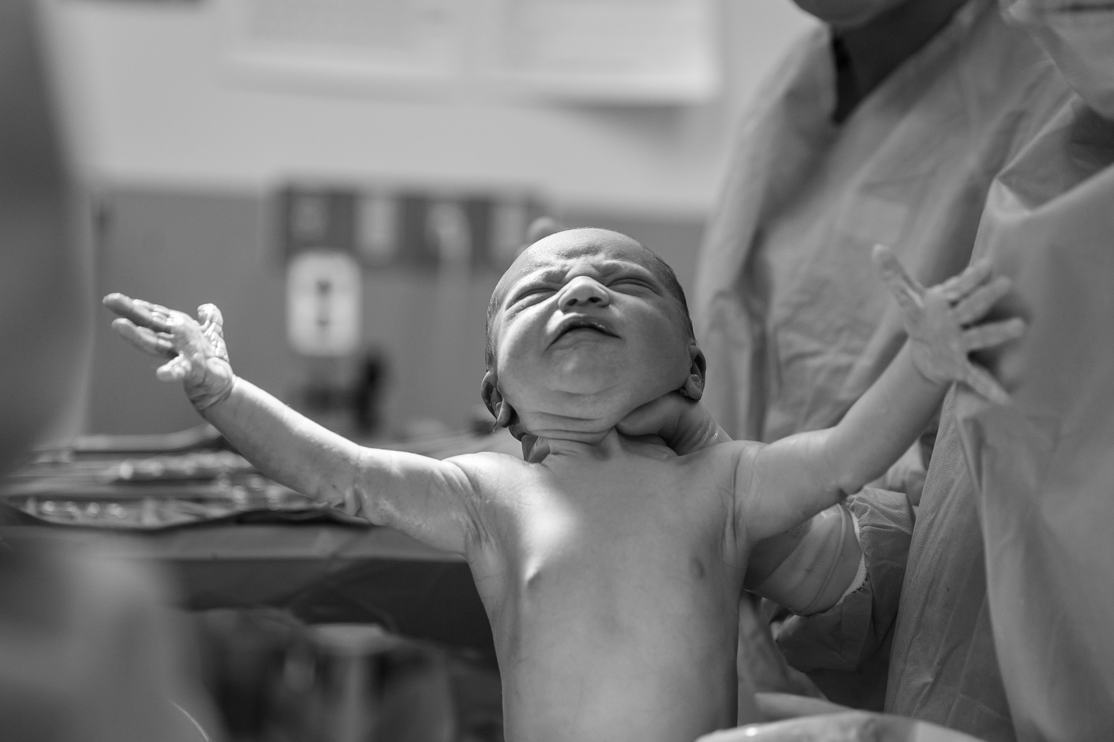 A newborn baby, eyes closed, arms outstretched, held by medical staff after birth. A newborn baby, eyes closed, arms outstretched, held by medical staff after birth.