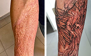 30 Scar Cover-Up Tattoos By Elvira Bono That Help People Feel Comfortable In Their Skin Again