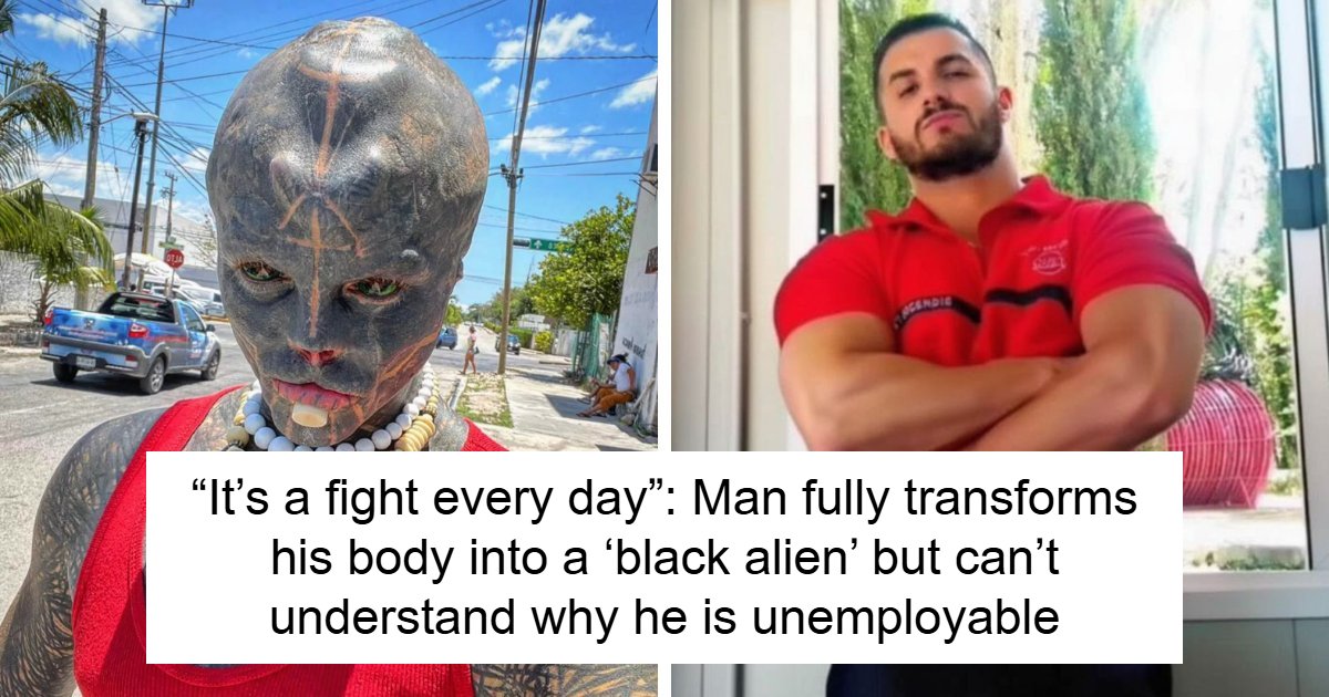 Man Gives Up His Nose, Ears And Fingers To Become A “Black Alien,” Shocked It Costs Him His Career