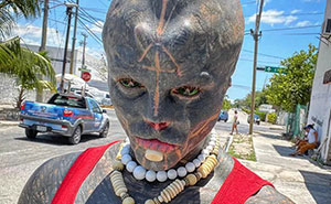 Man Gives Up His Nose, Ears And Fingers To Become A “Black Alien,” Shocked It Costs Him His Career