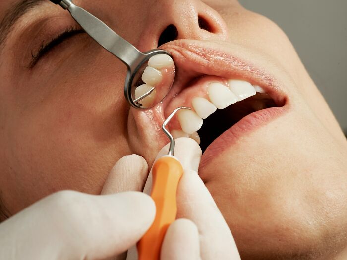 A dentist examining a patient's open mouth with tools, reflecting disturbing facts about dental health and hygiene.