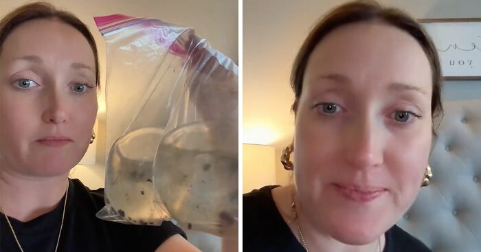 80 Rare Human Features That Make The Body Even More Incredible
