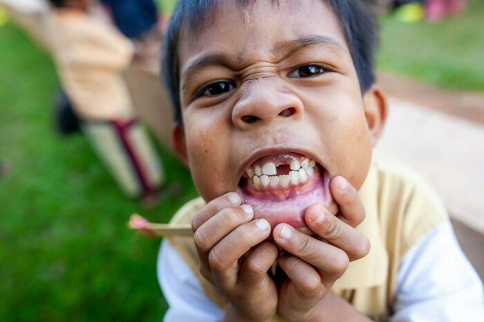 A young boy with a missing front tooth, making a funny face while holding his mouth open. This image depicts facts people wish they could forget.