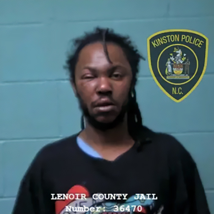 Mugshot of a man with an injured eye, one of the stupid arrests that made us lose faith in humanity.