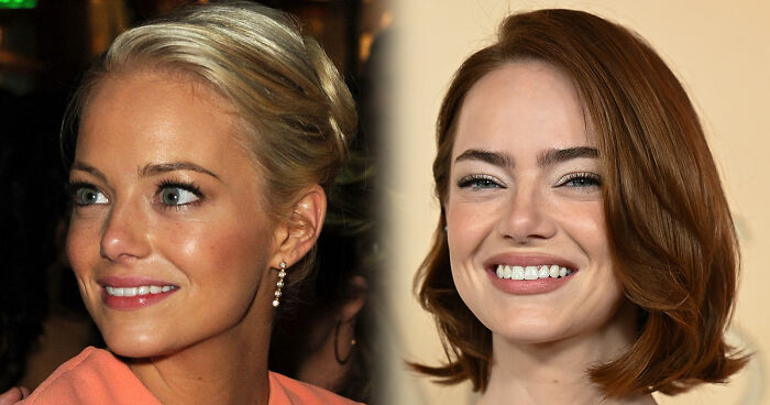 Doctor Exclusively Reveals Dangers Of New Beauty Trend Taking The Internet By Storm