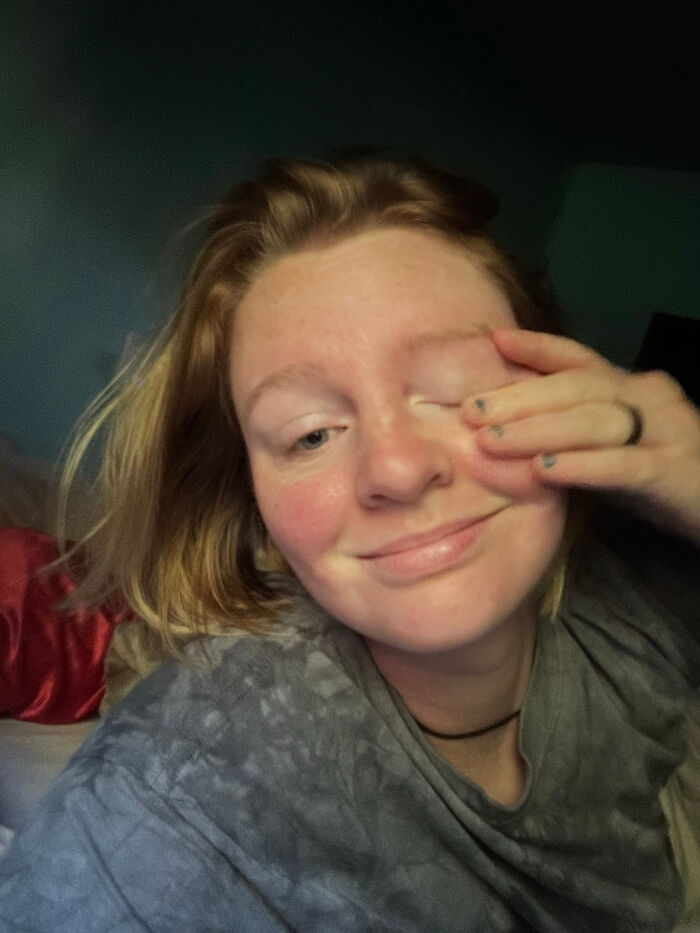 A woman with light hair rubs her eye, illustrating surprising facts about people's looks.