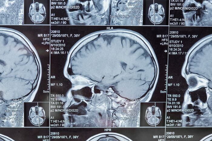 An MRI scan displaying human brain images. Disturbing facts changed the way people see the world.