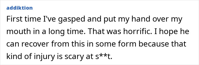 Screenshot of a comment from a user describing the English gymnast's horrific fall as scary and hoping for recovery.