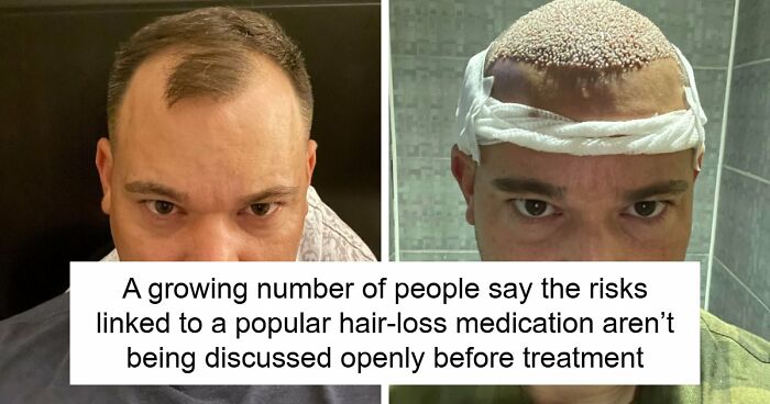 Healthy Man Trusts ChatGPT With His Diet And Ends Up In The Hospital, Doctors Are Concerned