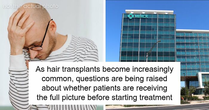 Hair Transplants Carry A Life-Changing Risk That Nobody Is Talking About