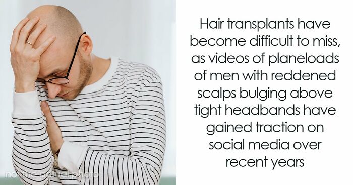 Hair Transplants Carry A Life-Changing Risk That Nobody Is Talking About