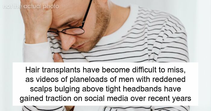 Hair Transplants Carry A Life-Changing Risk That Nobody Is Talking About
