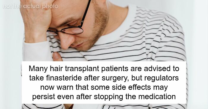 Hair Transplants Carry A Life-Changing Risk That Nobody Is Talking About