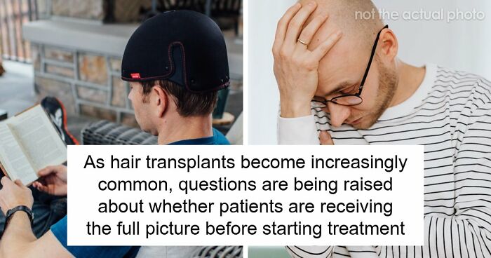Hair Transplants Carry A Life-Changing Risk That Nobody Is Talking About