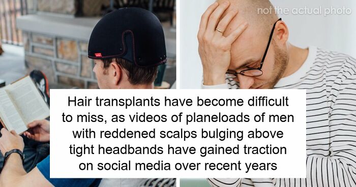 Hair Transplants Carry A Life-Changing Risk That Nobody Is Talking About