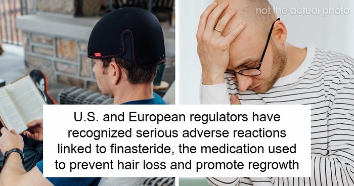 Hair Transplants Carry A Life-Changing Risk That Nobody Is Talking About