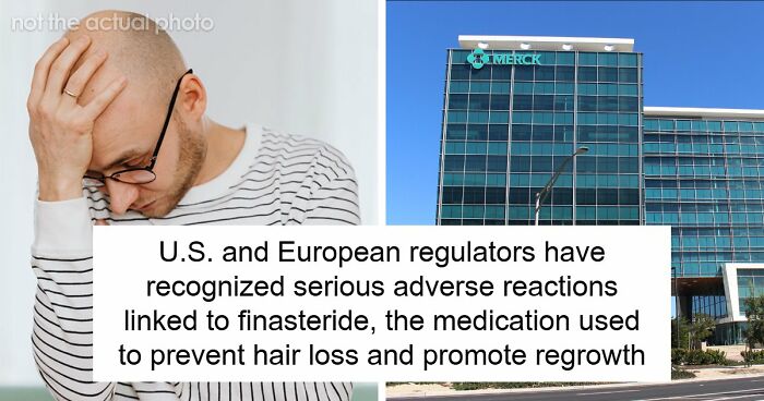 Hair Transplants Carry A Life-Changing Risk That Nobody Is Talking About