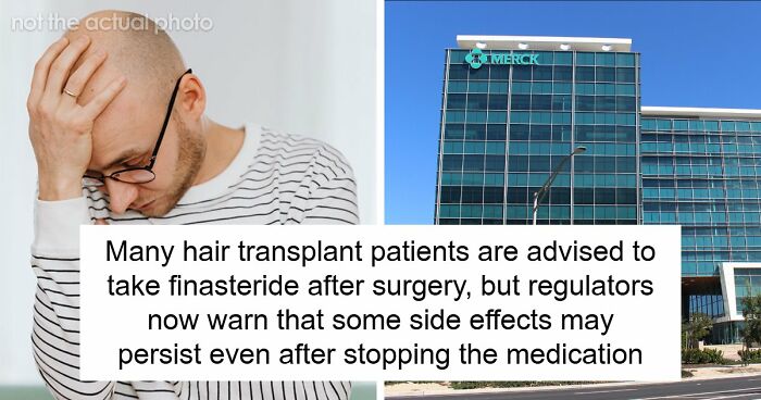 Hair Transplants Carry A Life-Changing Risk That Nobody Is Talking About