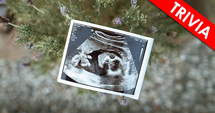 “Are You A Biology Buff?”: Prove It By Scoring 20/20 On This Human Body Quiz