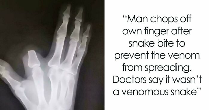 82 Fascinating Pics And Quick Facts For A 5-Minute Brain Boost (New Pics)