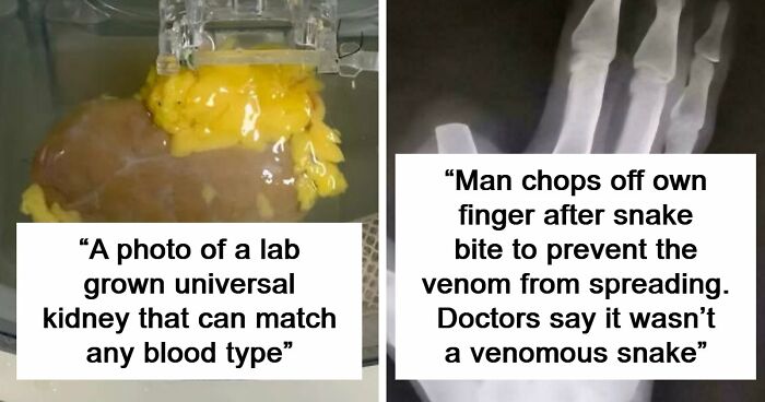 82 Fascinating Pics And Quick Facts For A 5-Minute Brain Boost (New Pics)