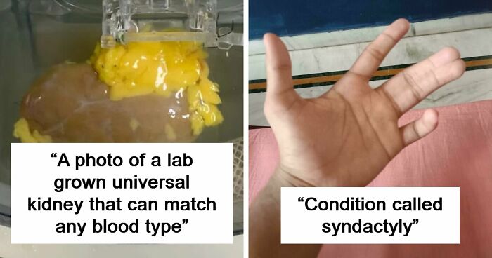 82 Fascinating Pics And Quick Facts For A 5-Minute Brain Boost (New Pics)