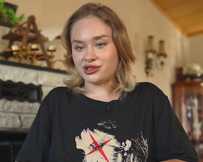 Close-up of a young woman who dreamed of being a famous model, showing facial scars from a party incident. Close-up of a young woman who dreamed of being a famous model, showing facial scars from a party incident.