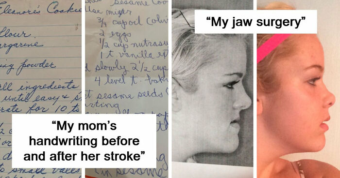 90 Mildly Interesting Before-And-After Photos That Show Just How Much Things Can Change