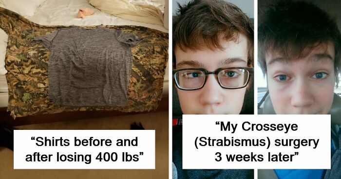 90 Mildly Interesting Before-And-After Photos That Show Just How Much Things Can Change